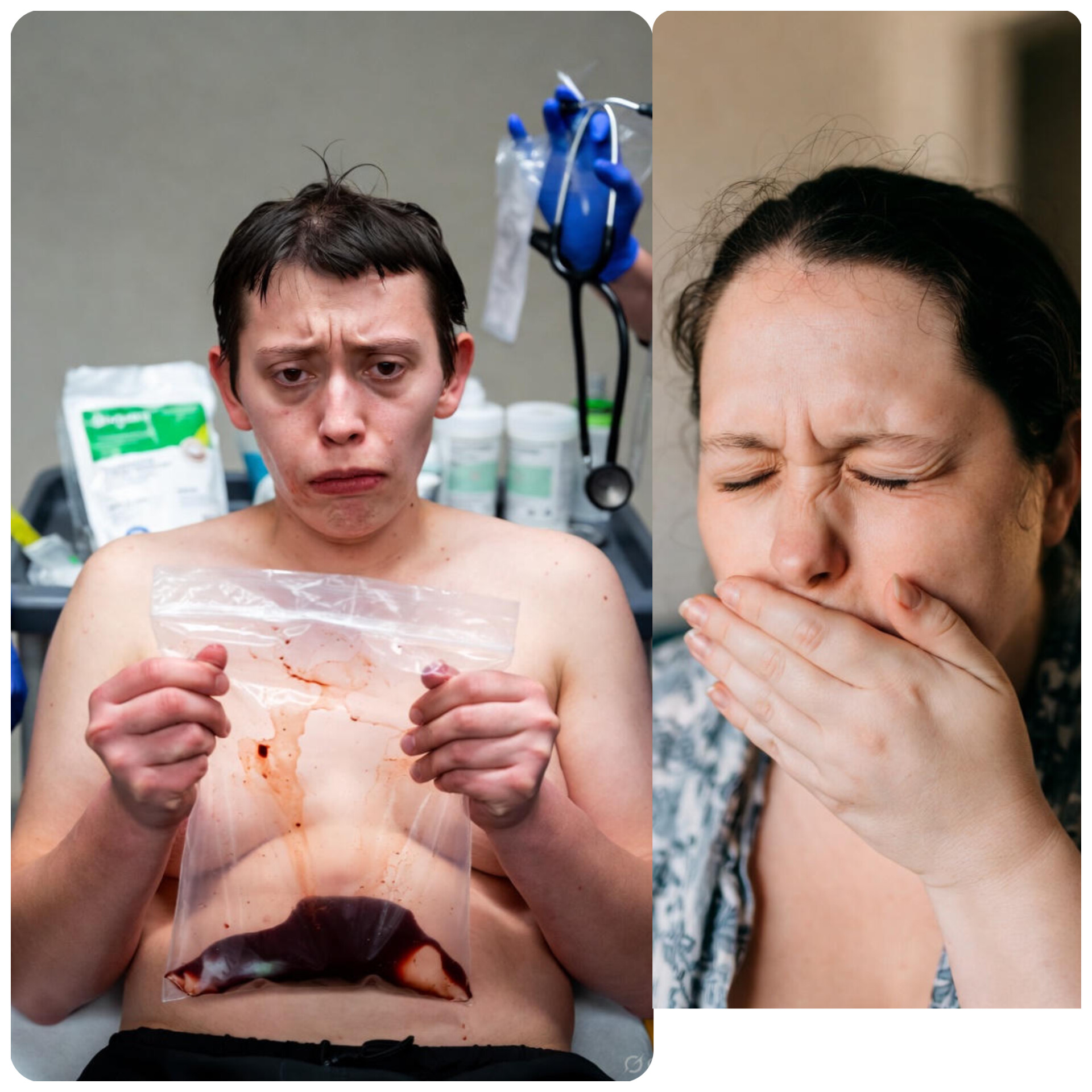 استفراغ خونی (Hematemesis) و اقدامات پیش‌بیمارستانی